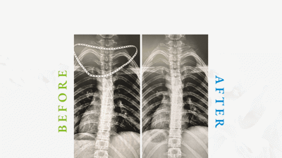 Corrected Curved Spine Photo